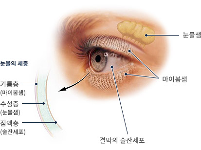 안구건조증의 원인