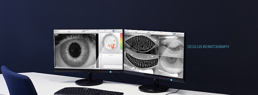 눈물막 정밀 분석 및 마이봄샘 기능 검사 (OCULUS Keratograph 5M)