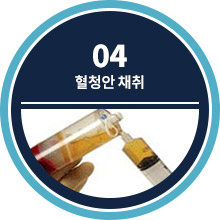 04 혈청안 채취