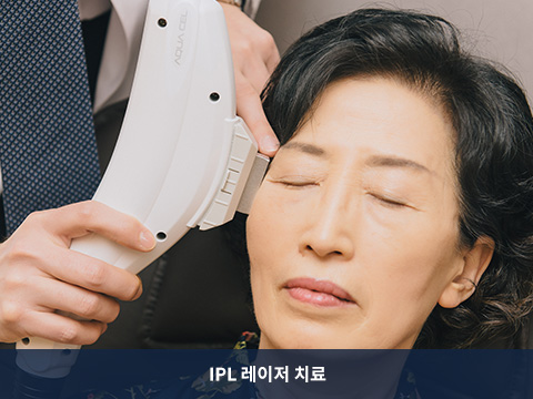 IPL 레이져 치료