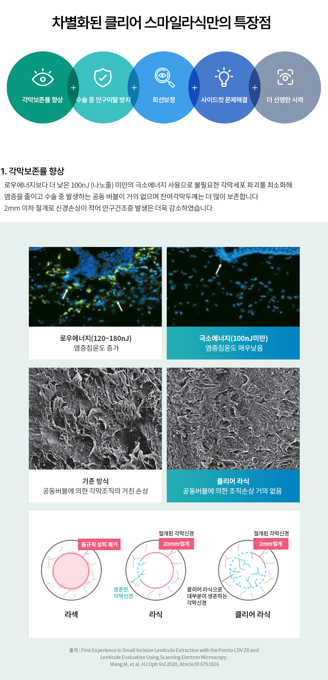 클리어 라식 최소 각막손상 , 수술 중 안구이탈방지