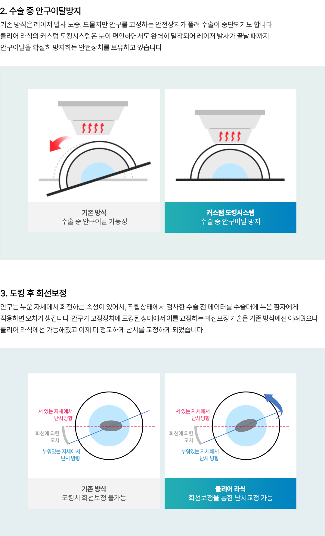 완벽한 회선보정, 사이드컷 문제해결